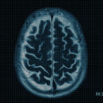 Transforming MRI Efficiency: How Numed Helped a Long-Time Customer Reduce Backlogs from 9 Weeks to 1 Day
