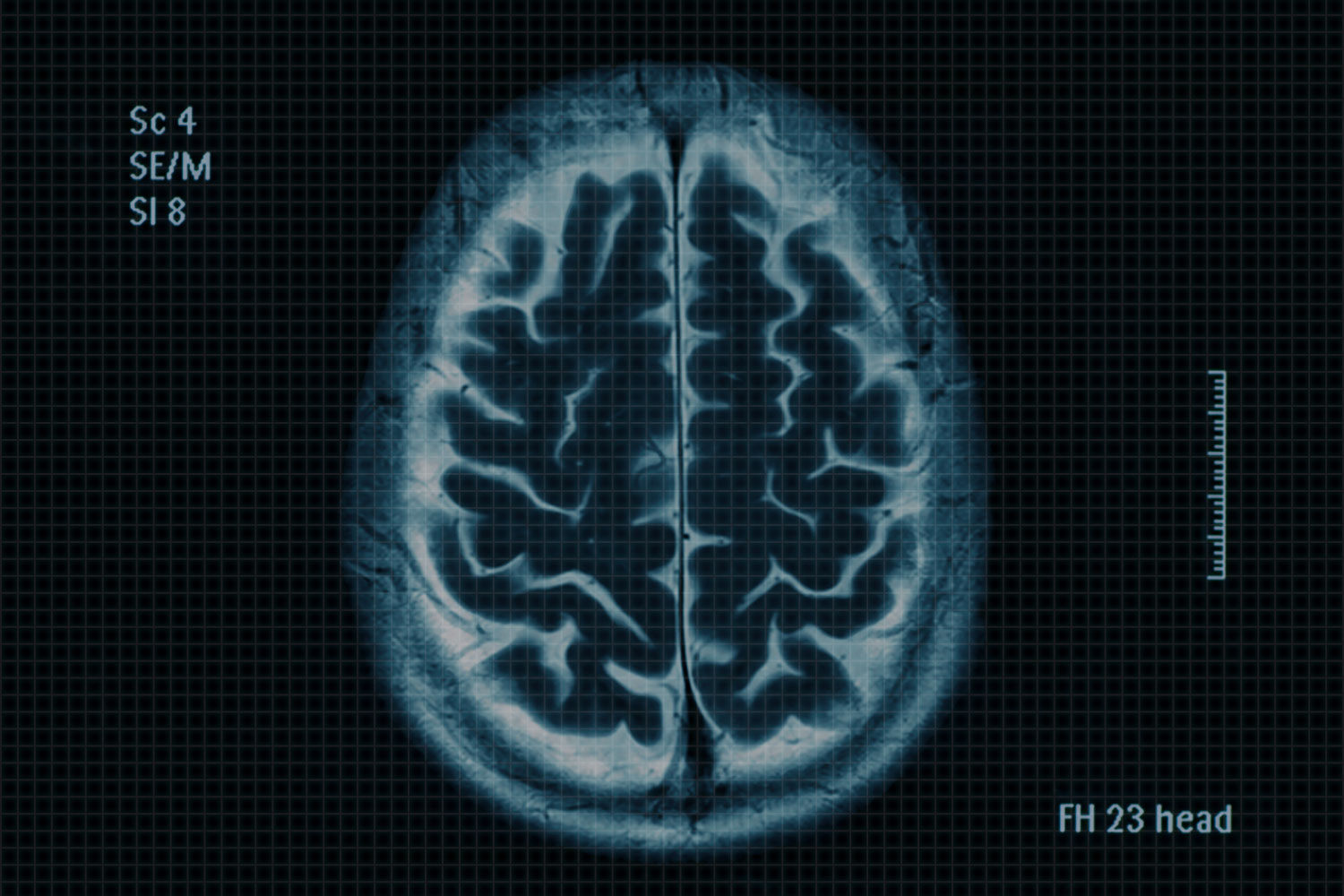 Transforming MRI Efficiency: How Numed Helped a Long-Time Customer Reduce Backlogs from 9 Weeks to 1 Day