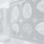 Expand Your Imaging Department with SPECT/CT