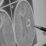 Adding MRI Systems to Your Imaging Department