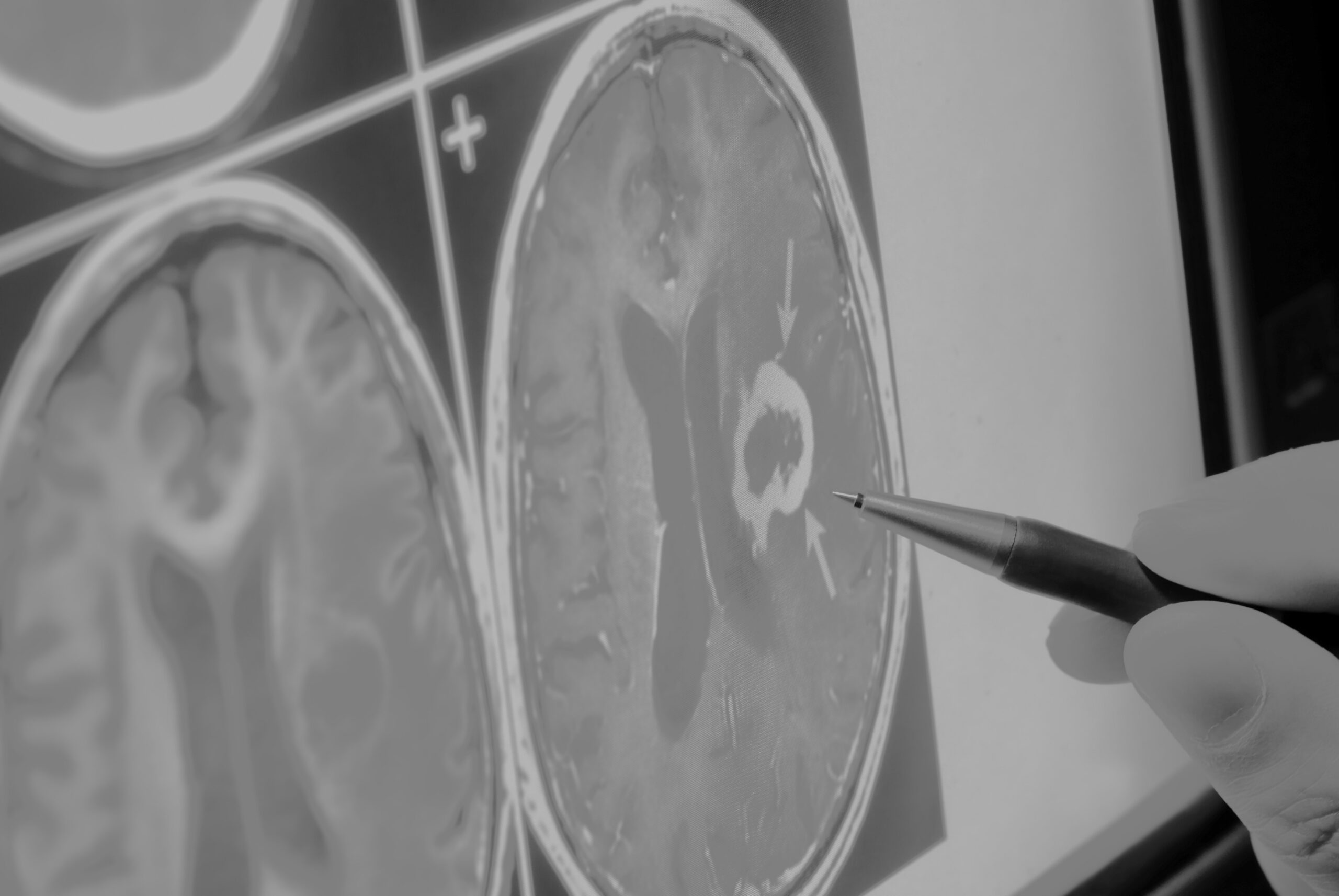 Adding MRI Systems to Your Imaging Department